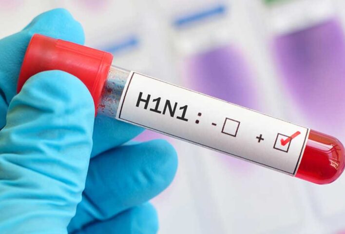H1N1 virüsü