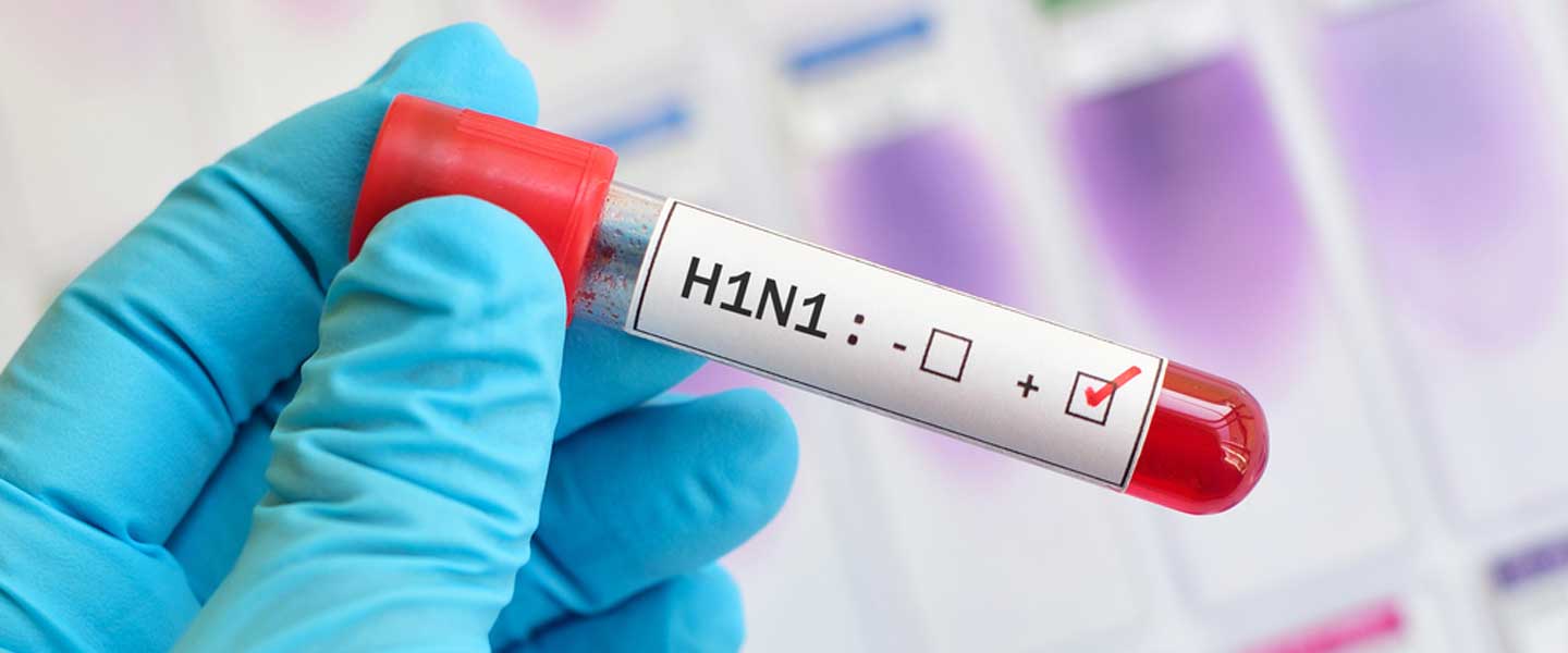 H1N1 virüsü