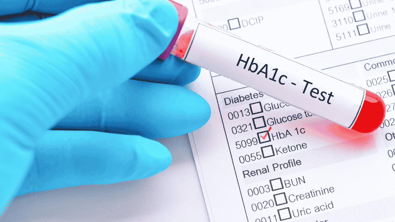 HbA1c Testi