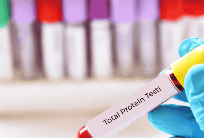 Total Protein Testi