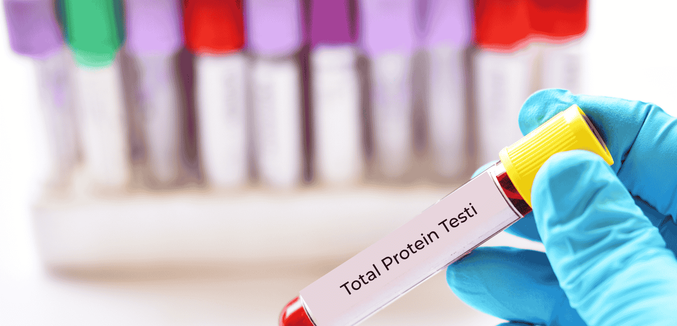 Total Protein Testi