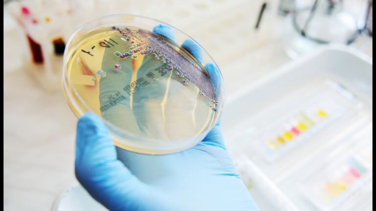 Vankomisin Testi, Nedir, Ne Zaman, Niçin Yapılır? Tetra Laboratuvar