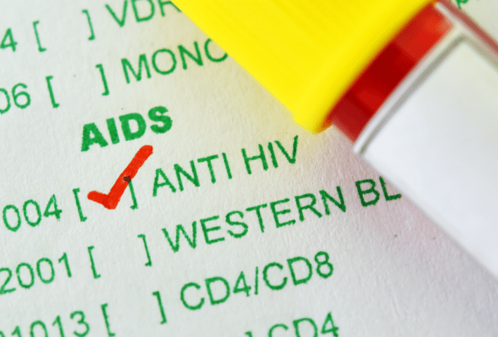 HIV Testi