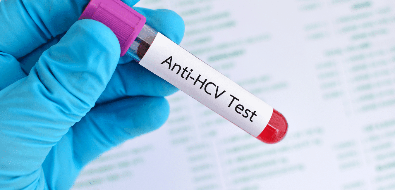 Anti HCV Testi