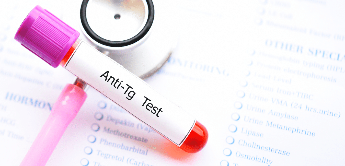 Anti TG Test Nedir? Nasıl Yapılır? - Tetra Tıp Laboratuvarı