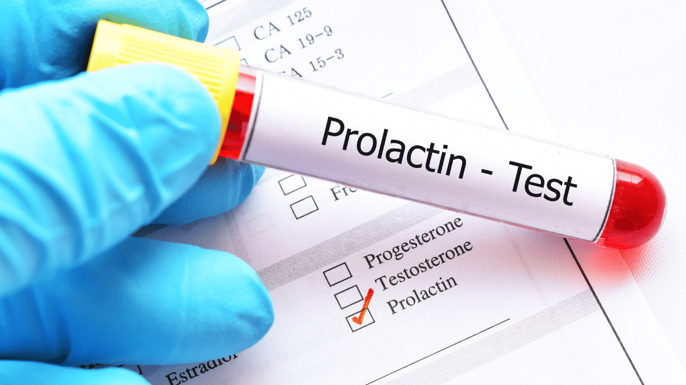 Prolaktin testi