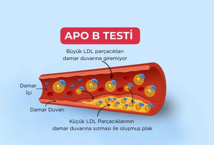 Apo B Testi